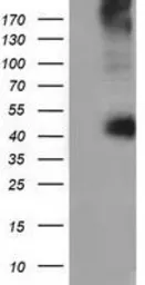 Anti-CD80 antibody [2B11] used in Western Blot (WB). GTX84701