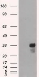 Anti-CD2 antibody [4E4] used in Western Blot (WB). GTX84724