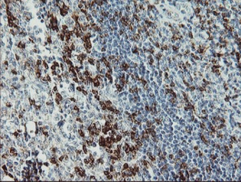 Anti-CD2 antibody [9D1] used in IHC (Paraffin sections) (IHC-P). GTX84725
