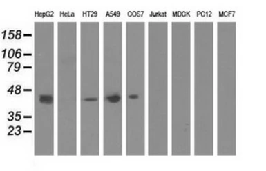 Anti-CBWD1 antibody [2D2] used in Western Blot (WB). GTX84727