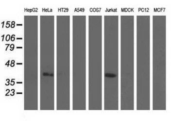 Anti-CBWD1 antibody [3F9] used in Western Blot (WB). GTX84732