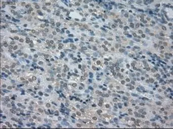 Anti-BUB1B antibody [11G2] used in IHC (Paraffin sections) (IHC-P). GTX84768