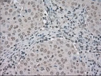 Anti-BUB1B antibody [5D9] used in IHC (Paraffin sections) (IHC-P). GTX84771