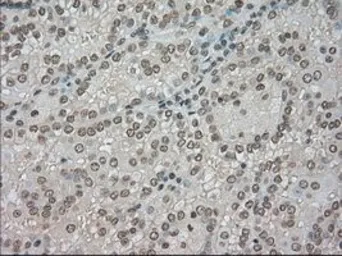 Anti-BUB1B antibody [5D9] used in IHC (Paraffin sections) (IHC-P). GTX84771