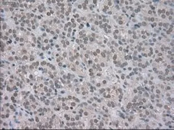 Anti-BUB1B antibody [5D9] used in IHC (Paraffin sections) (IHC-P). GTX84771