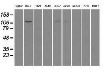 Anti-BUB1B antibody [5D9] used in Western Blot (WB). GTX84771