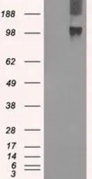 Anti-BUB1B antibody [5D9] used in Western Blot (WB). GTX84771