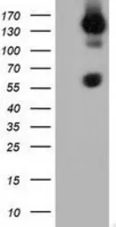 Anti-BTN1A1 antibody [5E6] used in Western Blot (WB). GTX84775