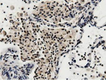 Anti-BTN1A1 antibody [7B5] used in IHC (Paraffin sections) (IHC-P). GTX84781