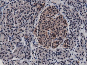 Anti-BTN1A1 antibody [7B5] used in IHC (Paraffin sections) (IHC-P). GTX84781