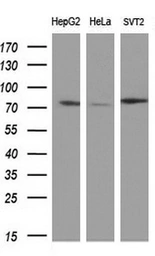 Anti-BTK antibody [10E10] used in Western Blot (WB). GTX84785