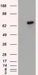 Anti-BTK antibody [10E10] used in Western Blot (WB). GTX84785