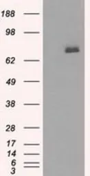 Anti-BTK antibody [12H4] used in Western Blot (WB). GTX84792