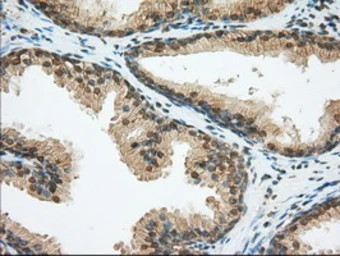 Anti-CD147 antibody [4E4] used in IHC (Paraffin sections) (IHC-P). GTX84798
