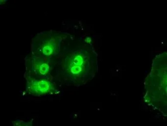 Anti-Livin antibody [1B10] used in Immunocytochemistry/ Immunofluorescence (ICC/IF). GTX84822