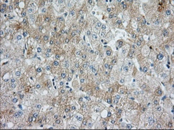 Anti-Survivin antibody [2D9] used in IHC (Paraffin sections) (IHC-P). GTX84824