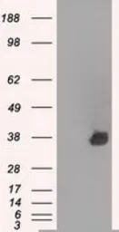 Anti-Aurora C antibody [10A7] used in Western Blot (WB). GTX84838