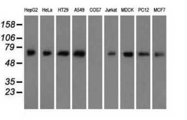 Anti-BMAL1 antibody [3G9] used in Western Blot (WB). GTX84851