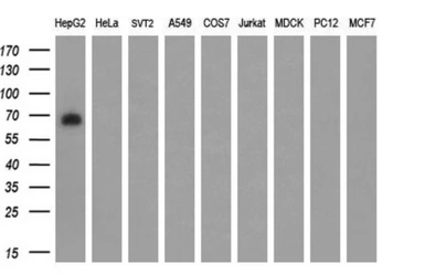 Anti-BMAL1 antibody [1D1] used in Western Blot (WB). GTX84853