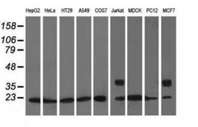 Anti-Rho GDI alpha antibody [1F2] used in Western Blot (WB). GTX84859