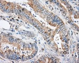 Anti-Rho GDI alpha antibody [1A7] used in IHC (Paraffin sections) (IHC-P). GTX84860