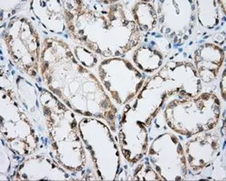 Anti-Rho GDI alpha antibody [1A7] used in IHC (Paraffin sections) (IHC-P). GTX84860