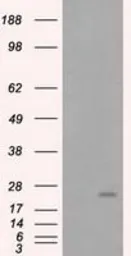 Anti-Rho GDI alpha antibody [1A7] used in Western Blot (WB). GTX84860