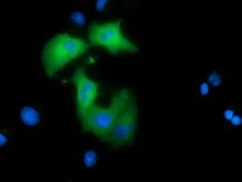 Anti-ARHGAP25 antibody [3G1] used in Immunocytochemistry/ Immunofluorescence (ICC/IF). GTX84863