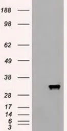 Anti-Apolipoprotein M antibody [3H3] used in Western Blot (WB). GTX84882