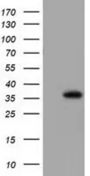 Anti-Annexin III antibody [1A9] used in Western Blot (WB). GTX84883
