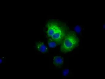 Anti-ALDH3A1 antibody [1B6] used in Immunocytochemistry/ Immunofluorescence (ICC/IF). GTX84889
