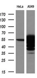 Anti-ALDH3A1 antibody [1B6] used in Western Blot (WB). GTX84889