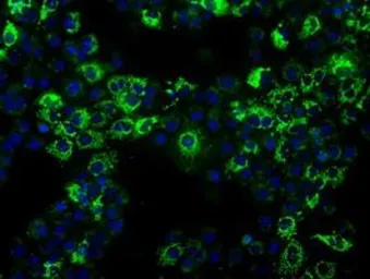 Anti-ALDH2 antibody [4H2] used in Immunocytochemistry/ Immunofluorescence (ICC/IF). GTX84890