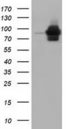 Anti-ALDH1L1 antibody [7G6] used in Western Blot (WB). GTX84894