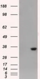 Anti-AKR1A1 antibody [4G2] used in Western Blot (WB). GTX84912