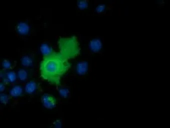 Anti-AK5 antibody [2F9] used in Immunocytochemistry/ Immunofluorescence (ICC/IF). GTX84921