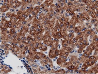 Anti-AK5 antibody [2F9] used in IHC (Paraffin sections) (IHC-P). GTX84921