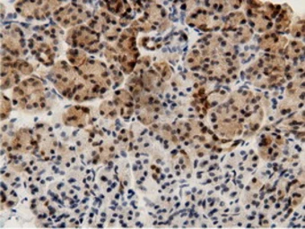 Anti-AK5 antibody [2F9] used in IHC (Paraffin sections) (IHC-P). GTX84921