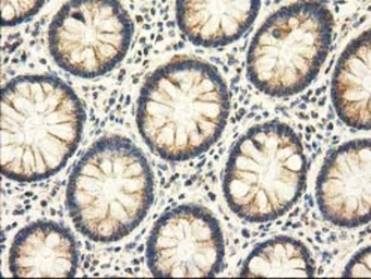 Anti-AK3 antibody [4C4] used in IHC (Paraffin sections) (IHC-P). GTX84933