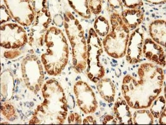Anti-AK3 antibody [4C4] used in IHC (Paraffin sections) (IHC-P). GTX84933