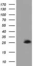 Anti-AK3 antibody [4C4] used in Western Blot (WB). GTX84933