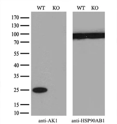 Anti-Adenylate kinase 1 antibody [18C7] used in Western Blot (WB). GTX84937