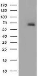 Anti-Alpha fetoprotein / AFP antibody [3G3/2D3] used in Western Blot (WB). GTX84948