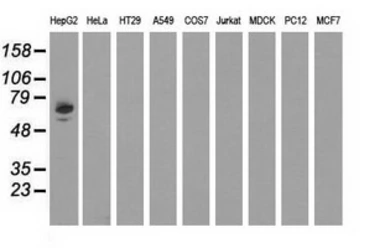 Anti-Alpha fetoprotein / AFP antibody [1E8] used in Western Blot (WB). GTX84953