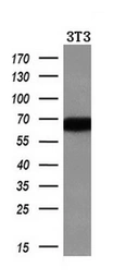 Anti-Alpha fetoprotein / AFP antibody [2A9] used in Western Blot (WB). GTX84954