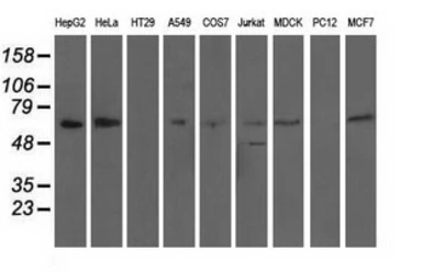 Anti-Alpha fetoprotein / AFP antibody [2A9] used in Western Blot (WB). GTX84954