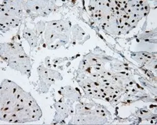 Anti-ATP citrate lyase antibody [3G8] used in IHC (Paraffin sections) (IHC-P). GTX84967