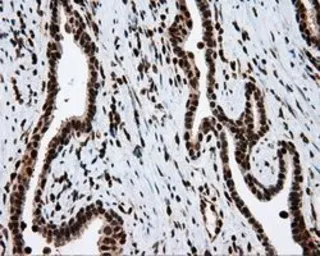 Anti-ATP citrate lyase antibody [3G8] used in IHC (Paraffin sections) (IHC-P). GTX84967