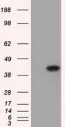 Anti-ACAT2 antibody [3C9] used in Western Blot (WB). GTX84971