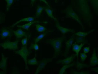 Anti-ACAT2 antibody [1C5] used in Immunocytochemistry/ Immunofluorescence (ICC/IF). GTX84977